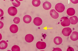 Platelets from Tulane