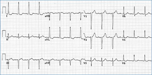 Figure 4c