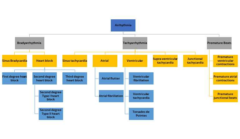 Arrhythmias