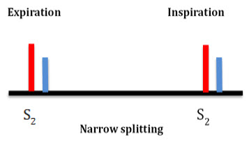 Narrow Splitting