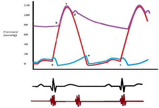 Cardiac Murmur Chart