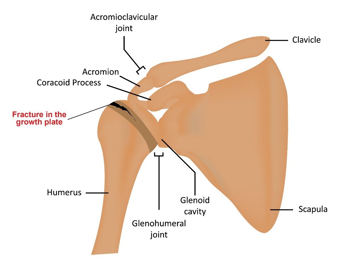 acromioclavicular