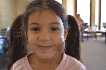 4-year-old Adrianna De La Cruz smiles with her newly reconstructed cheek.