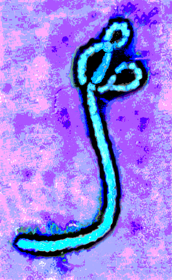 Ebola virus