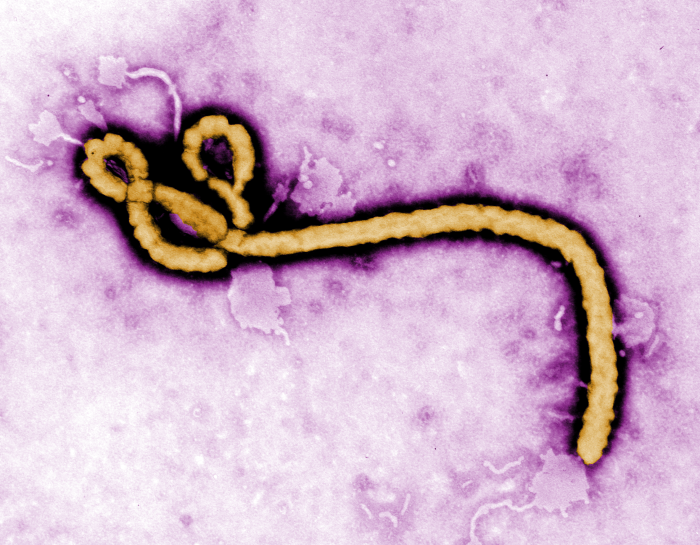 UTMB scientists awarded $11.3 million for new studies on Ebola virus