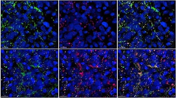 DIV Cerebral Organoids