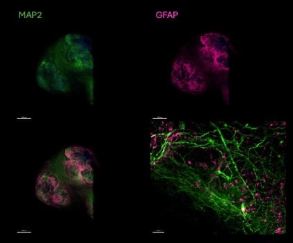 Organoid Mapping Images