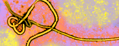 2014-Ebola-virus