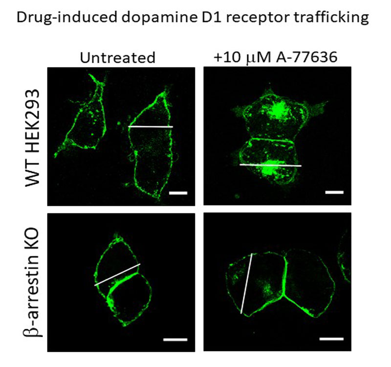 Dopamine-D1-receptor-trafficking