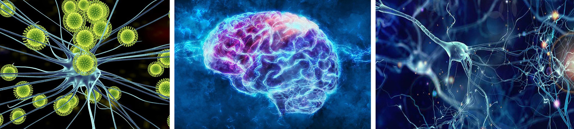 Scientific illustrations show viruses interacting with neurons, a human brain with neural activity, and interconnected nerve cells related to neuroinfectious disease research.