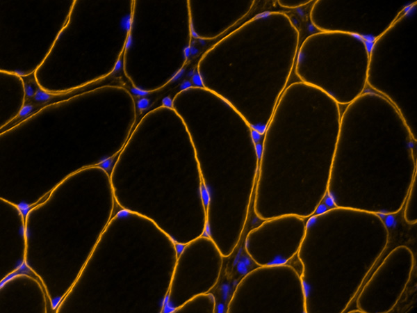 Black image with neon outlines of skeletal muscle.