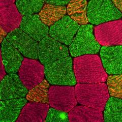 Human Muscle Cell Image from the Muscle Biology Laboratory 