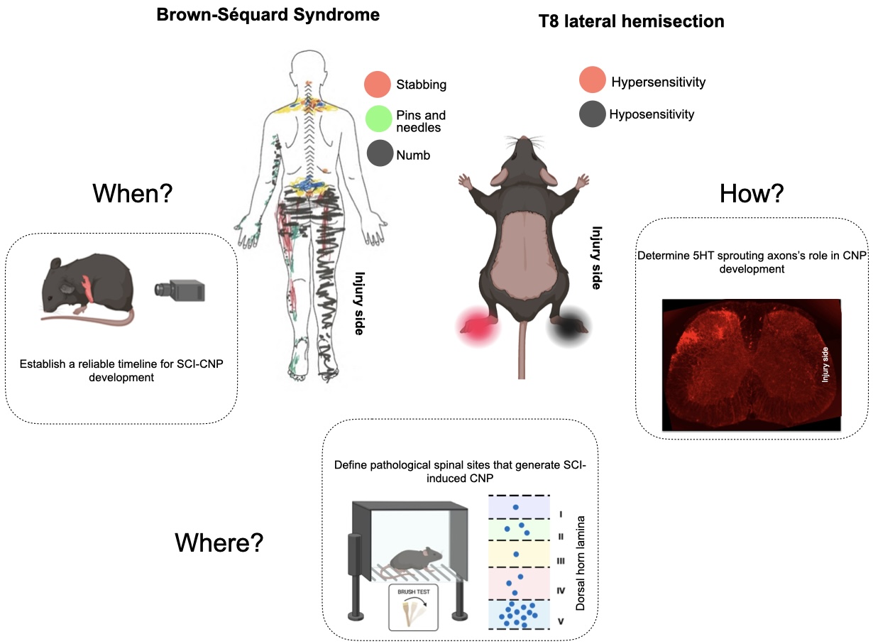 A diagram illustrates Brown-Séquard syndrome from a T8 spinal cord hemisection with sensory changes shown in a human figure and rodent model.