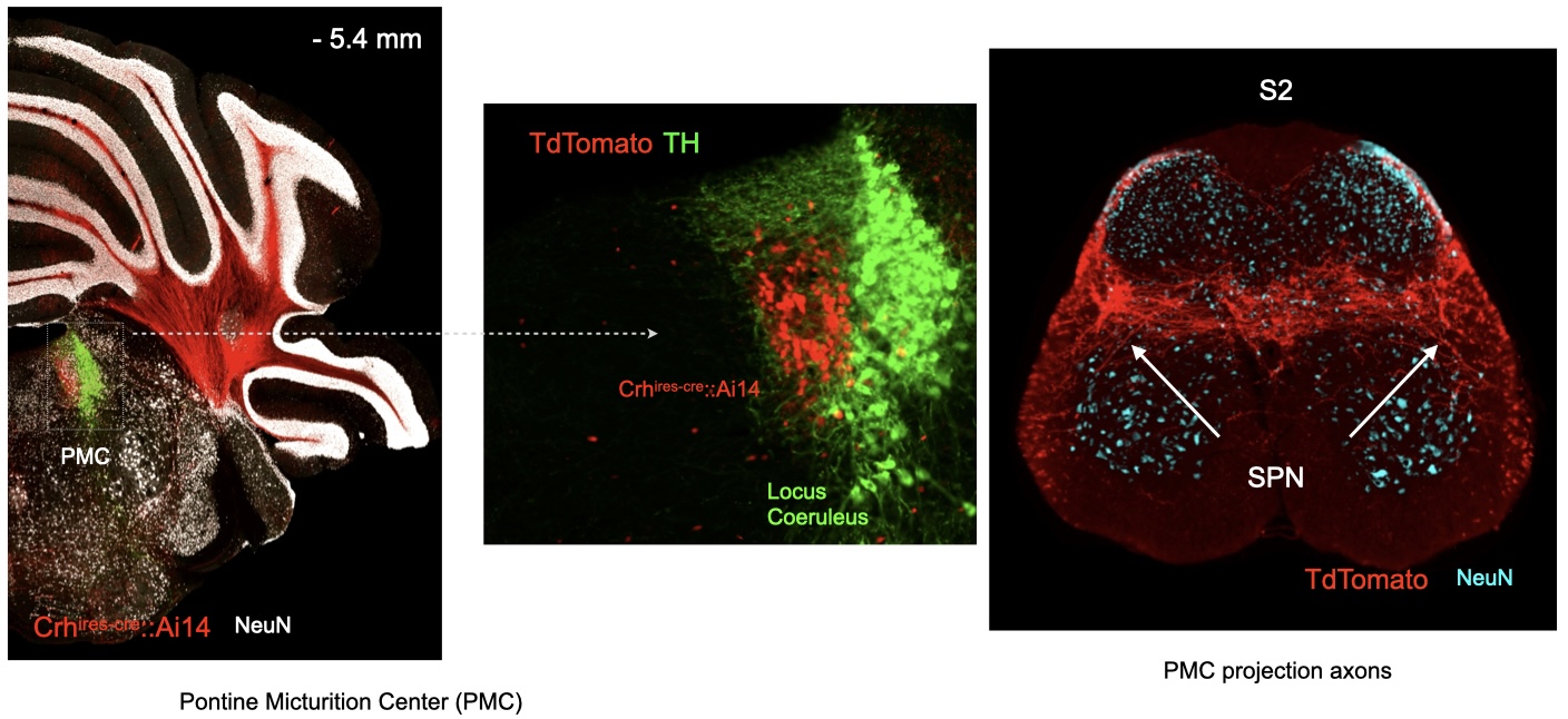 Fluorescent images of PMC brains