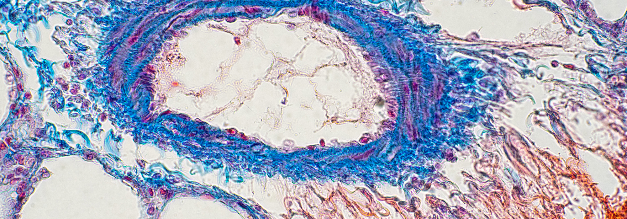 Lung Tissue main page