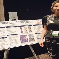 UTMB pathology resident standing beside a research poster on antibody-mediated pancreas rejection, featuring histology images and diagnostic criteria, displayed on an easel at a medical conference.