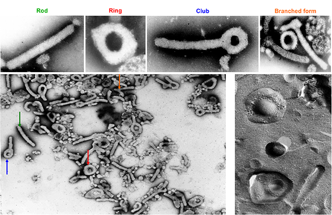Electron microscopy images of Marburg virus by E. Kandrushin and A. Bukreyev, 1989