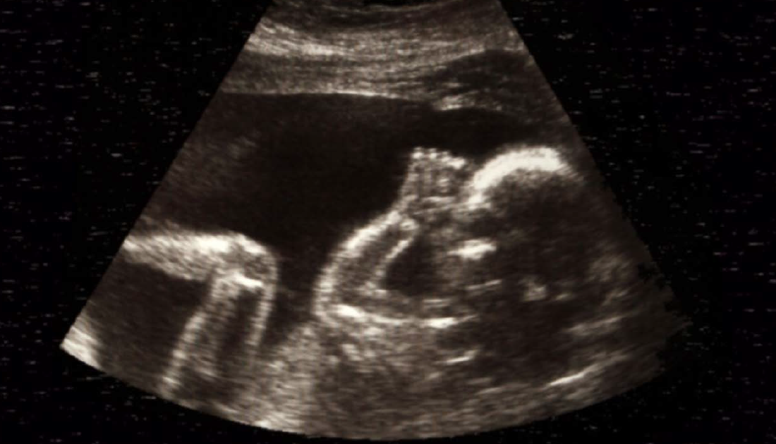 Image of Ultrasound 