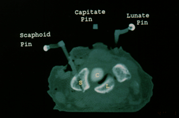 adj_Research-LabHistoryCT