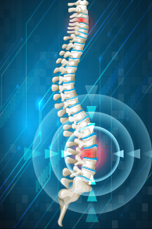 Spine Surgery Spine Surgery