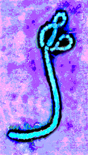 Ebola 1 colorized 6 thumbnail