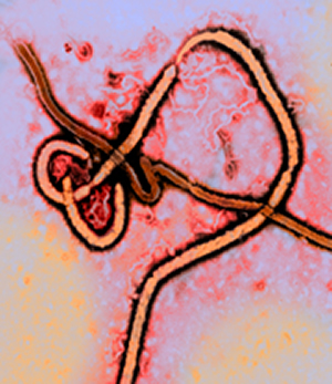 Ebola_2_colorized_3