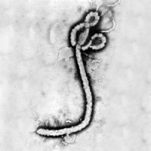 Ebola filovirus