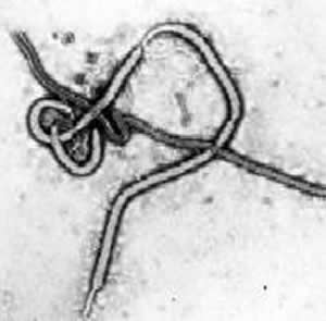 Ebola_virus_2