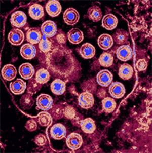Herpes simplex virus colorized