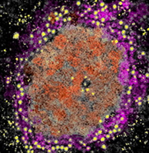 Human_rotavirus_thin_section_colorized