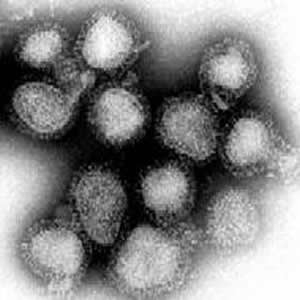 Influenza_virus