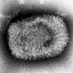 Smallpox_virus_neg_stn