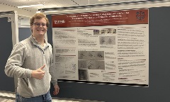 Person standing beside a UTMB research poster on development of a catheter-deliverable hydrogel embolic platform for endovascular therapy, giving a thumbs-up in an indoor academic setting.