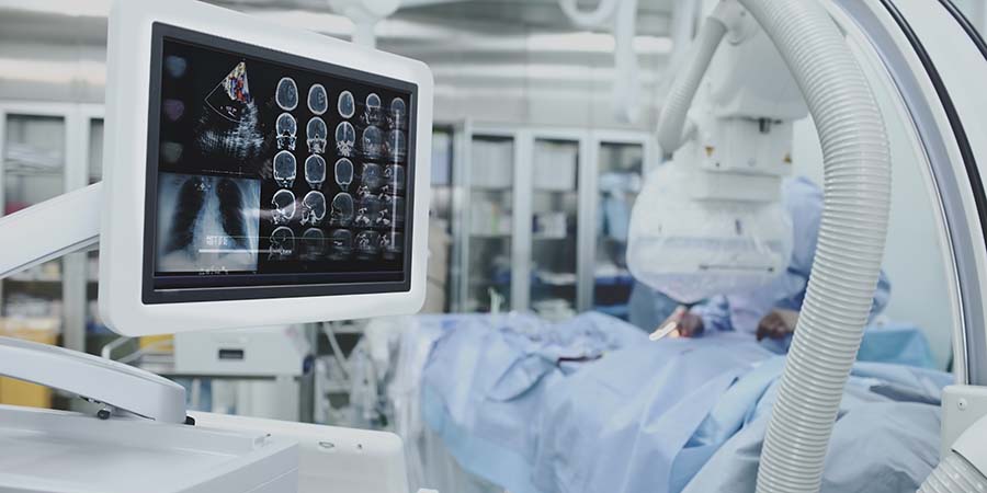 Operating room scene showing a surgical monitor displaying brain imaging scans beside advanced medical equipment