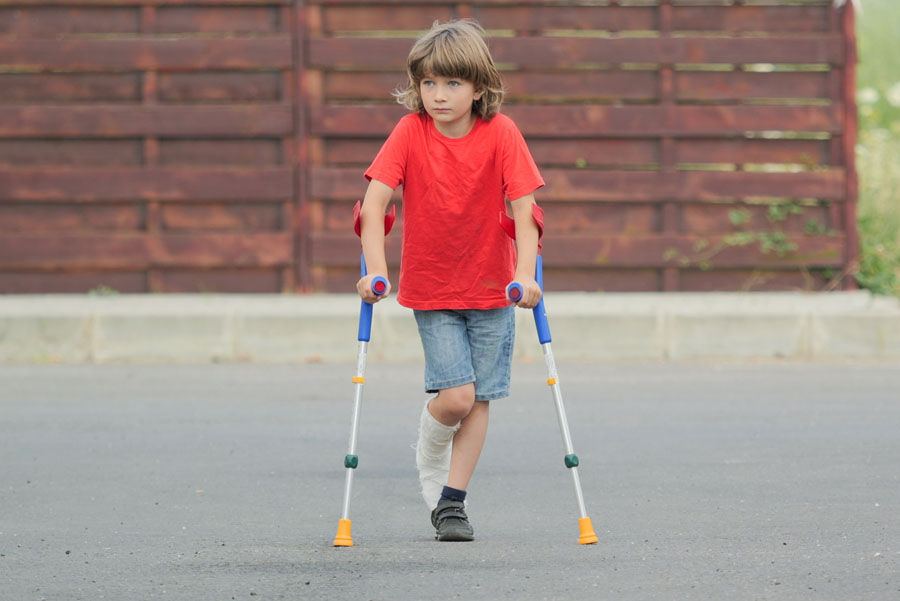 Boy with fractured leg in plaster cast, walking with medical orthopedic crutches from UTMB Health.