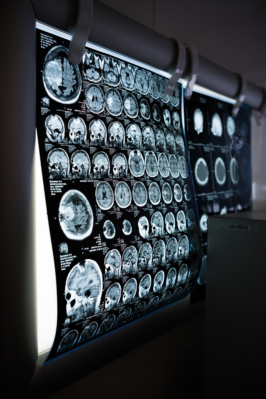 MRI images of brains on a light box