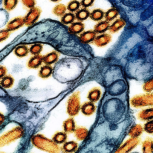 A colorized electron microscope image of avian influenza grown in cultured cells.