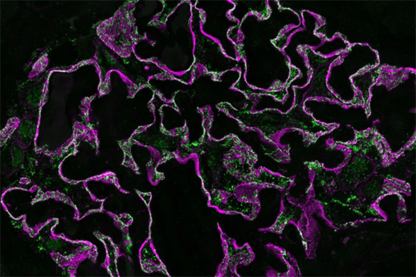 microscopic view of Glomerular channels required for normal renal function, black background, purple and green coloring