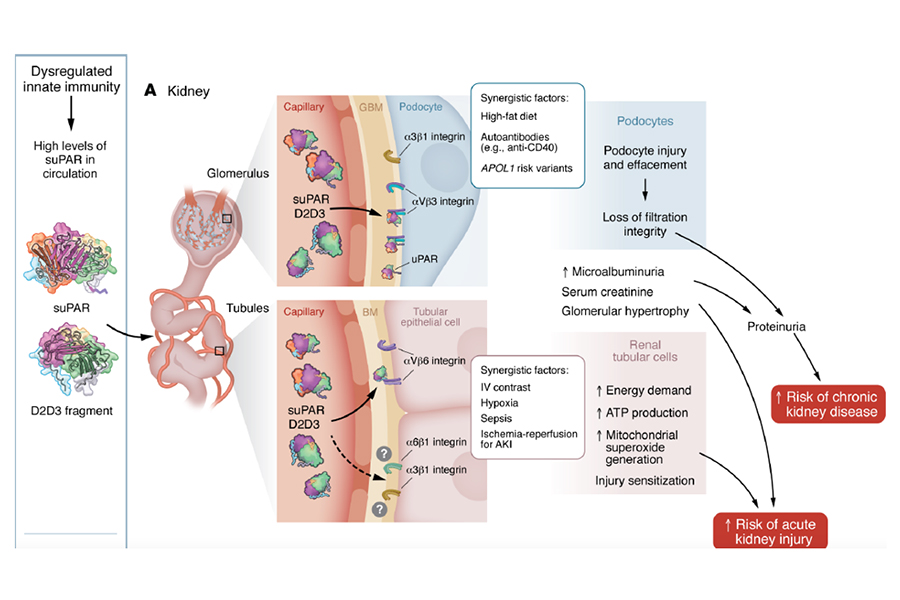 Graph explaining the role of suPAR and related proteins in kidney, heart diseases, and diabetes