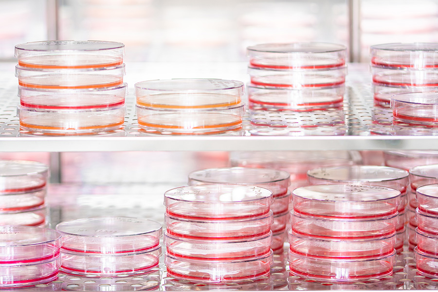 stacks on petri dishes