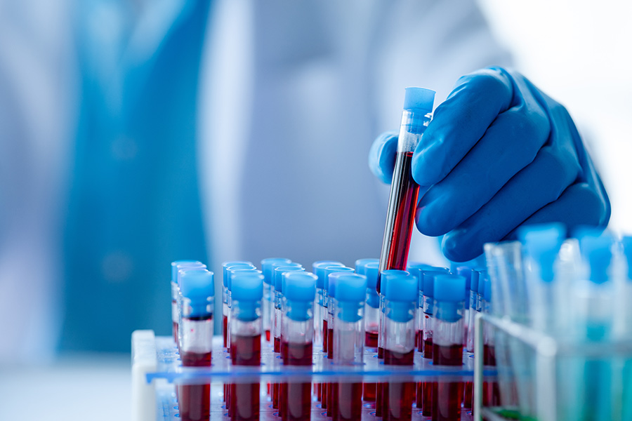 Test tubes with red liquid