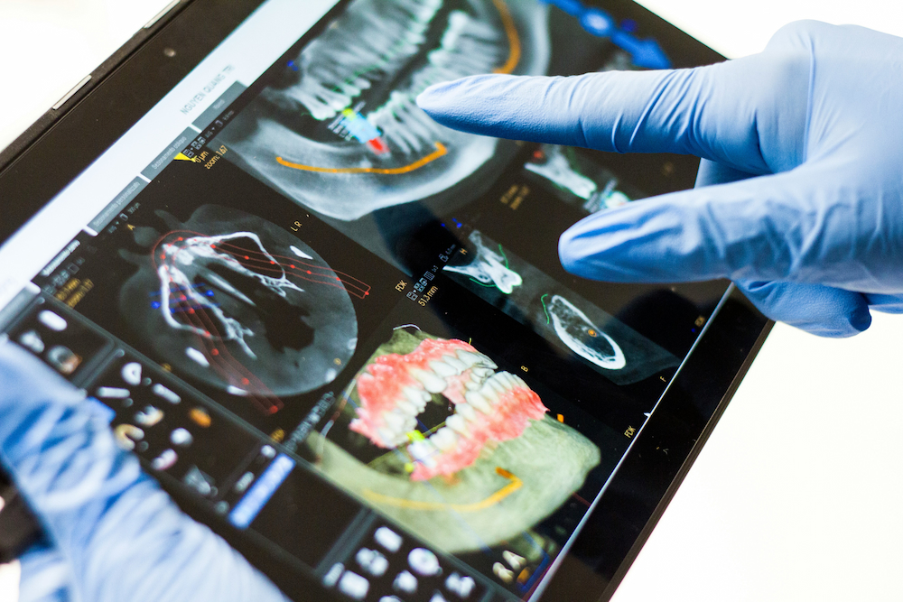 A close-up photo of a tablet displaying dental scans
