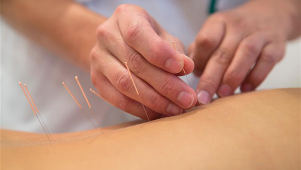 Two hands place acupuncture needles into a patient's skin