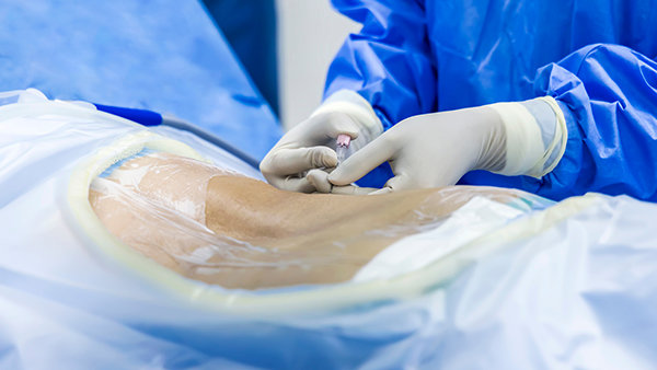 A doctor's gloved hands are seen performing a lumbar puncture on a patient whose back is mostly covered.