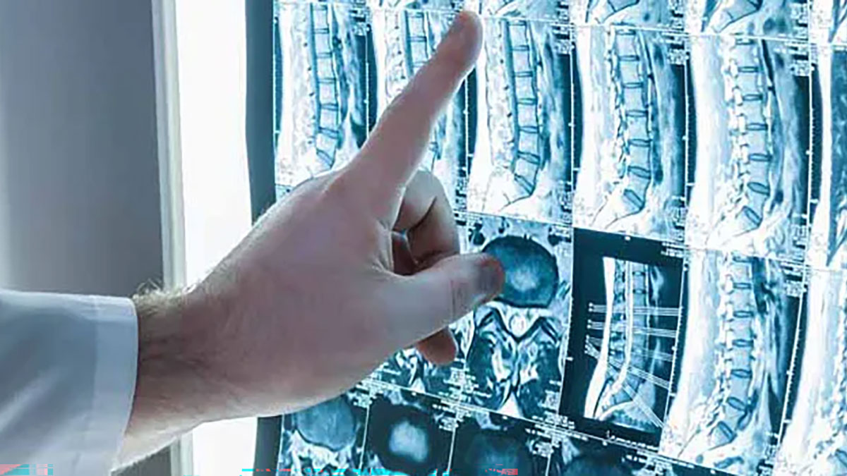 A doctor's hand is seen touching a screen that displays images of a patient's spine