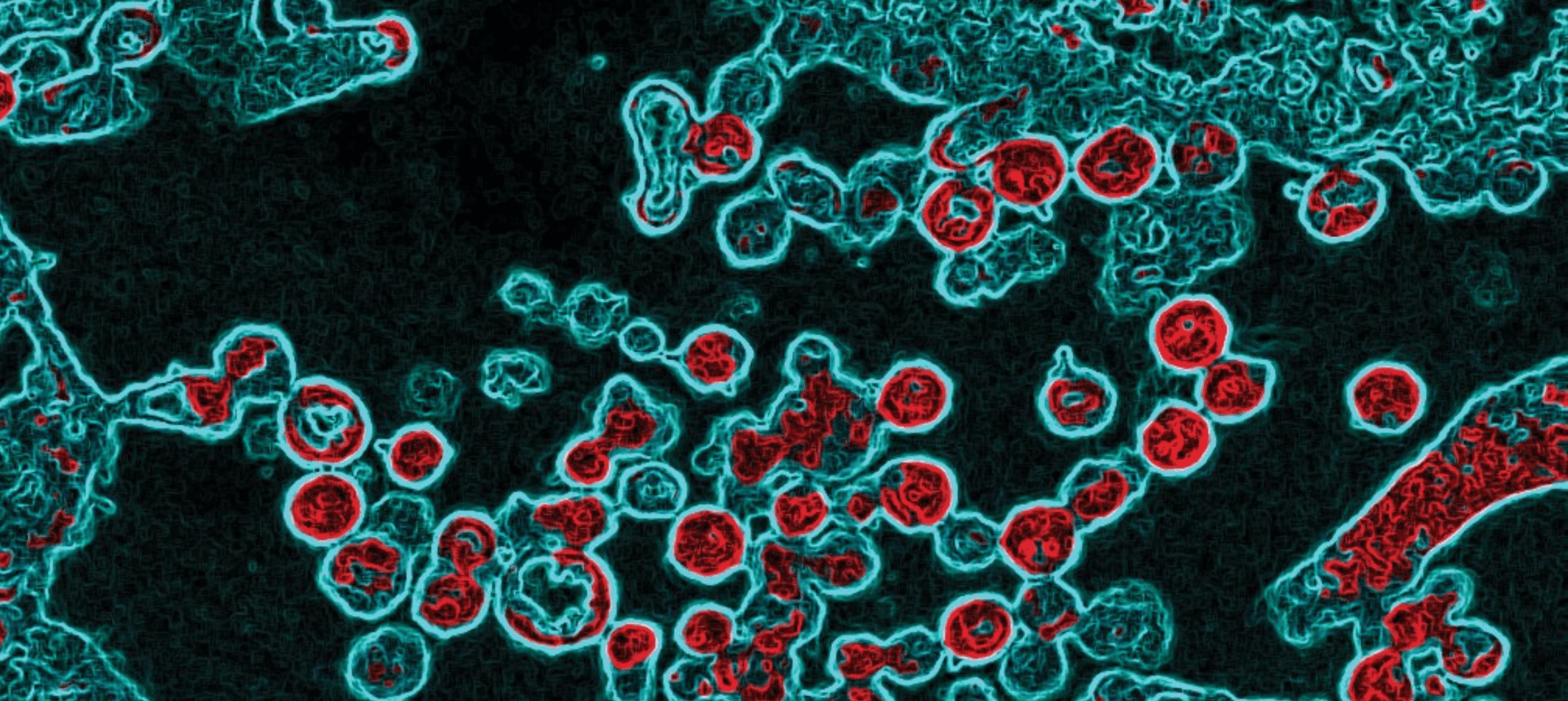 A color enhanced electron micrograph of Lassa virus particles.