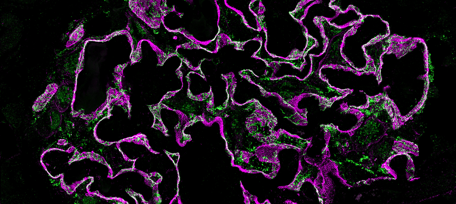 Using the Podocyte Exact Morphology Measurement Procedure technology, doctors atUTMB can create images that visualize fine and early structural changes inside specialized kidney cells known as podocytes.