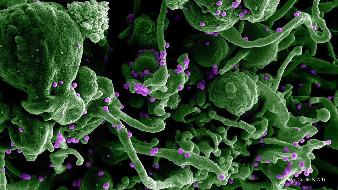 Scanning electron micrograph of Lassa virus budding off a cell Credit: NIAID