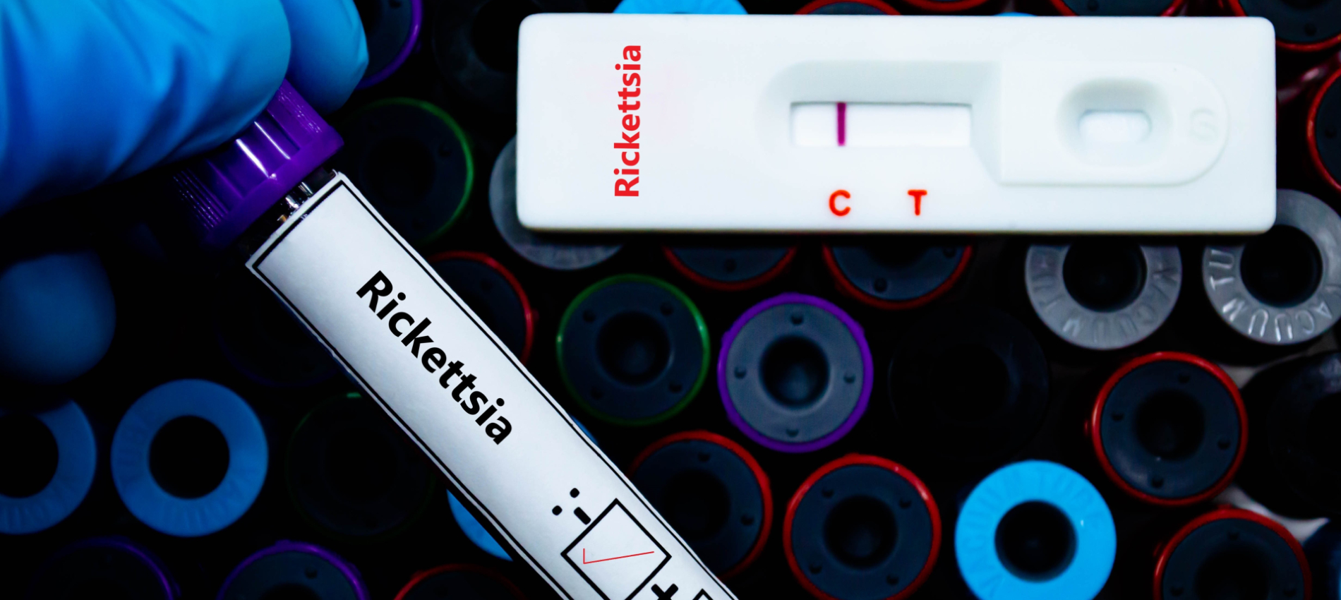 Gloved hand holding a blood sample tube labeled “Rickettsia” next to a rapid test cassette labeled “Rickettsia” with one visible line in the result window, against a background of multicolored specimen tube caps.