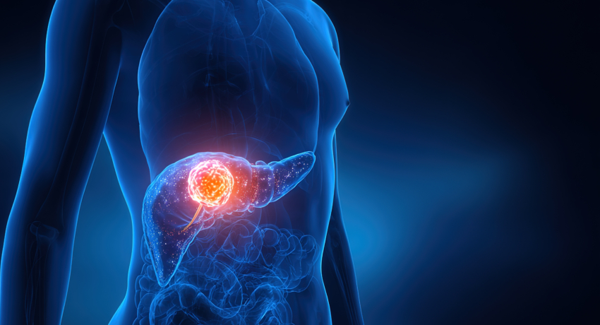 The pancreas, located behind the stomach, plays an important role in digestion and blood sugar regulation. New treatments targeting pancreatic cancer are giving researchers promising new ways to fight the disease.